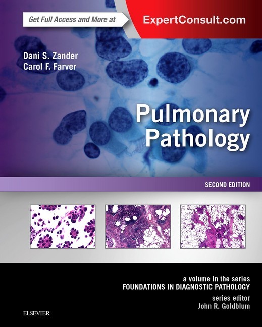 Pulmonary Pathology E-Book