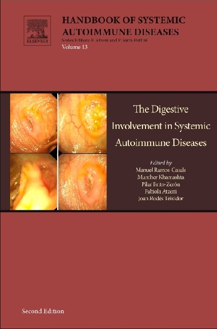 The Digestive Involvement in Systemic Autoimmune Diseases