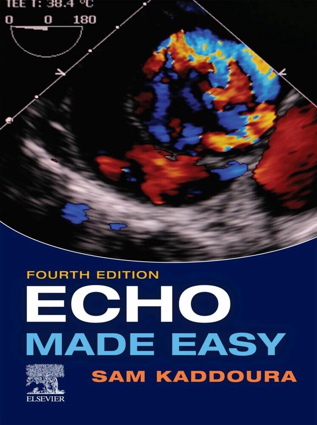 Echo Made Easy , E-Book