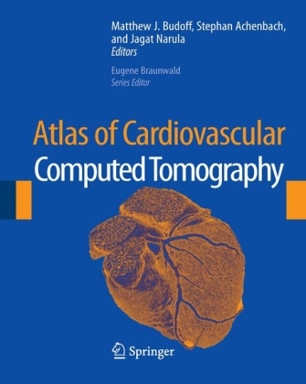 Atlas of Cardiovascular Computed Tomography, 1 CD-ROM