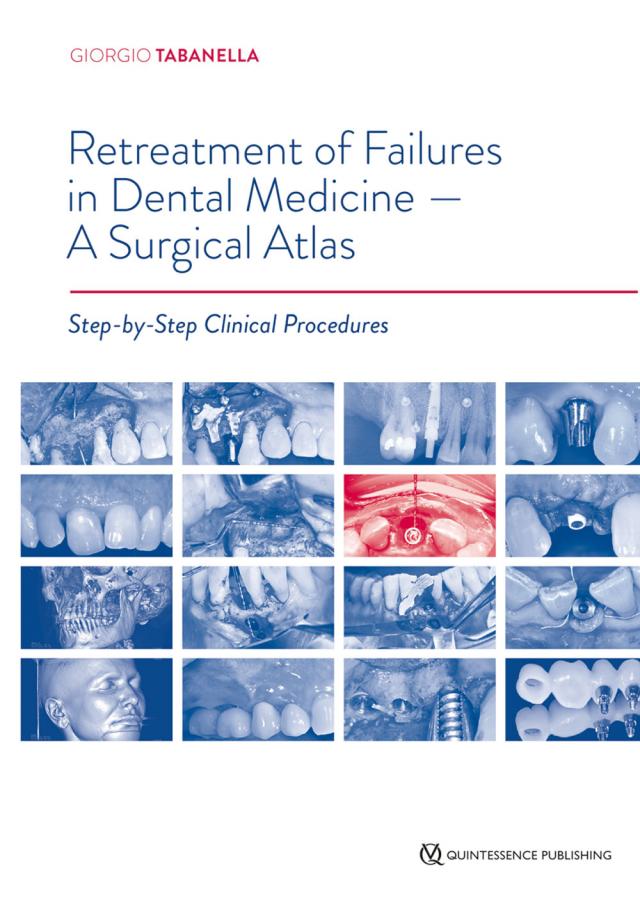 Retreatment of Failures in Dental Medicine - A Surgical Atlas