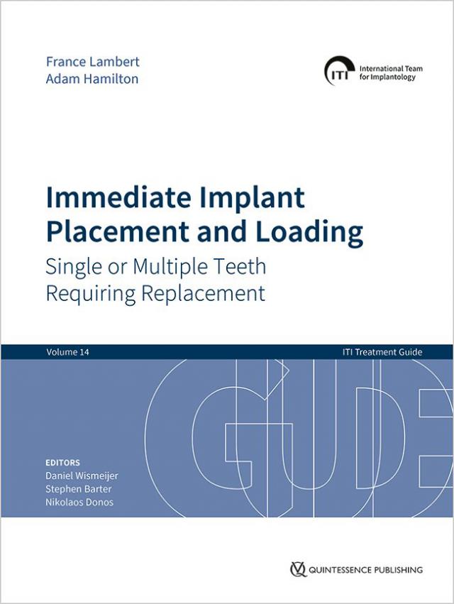 Immediate Implant Placement and Loading – Single or Multiple Teeth Requiring Replacement