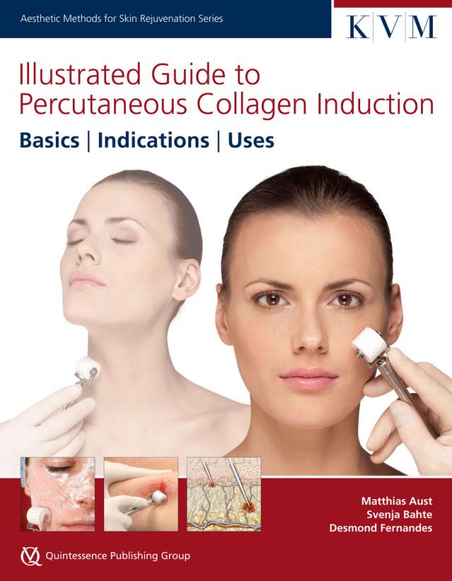 Illustrated Guide to Percutaneous Collagen Induction