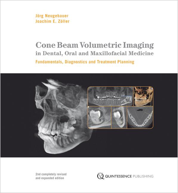 Cone Beam Volumetric Imaging in Dental, Oral and Maxillofacial Medicine