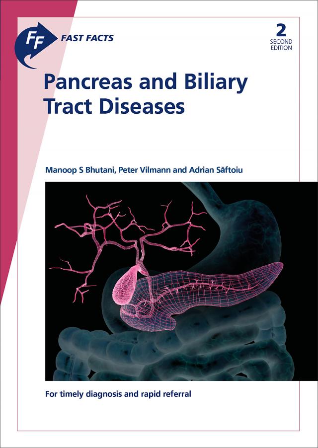 Fast Facts: Pancreas and Biliary Tract Diseases