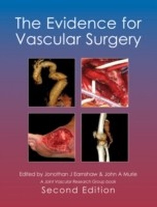 Evidence for Vascular Surgery; second edition
