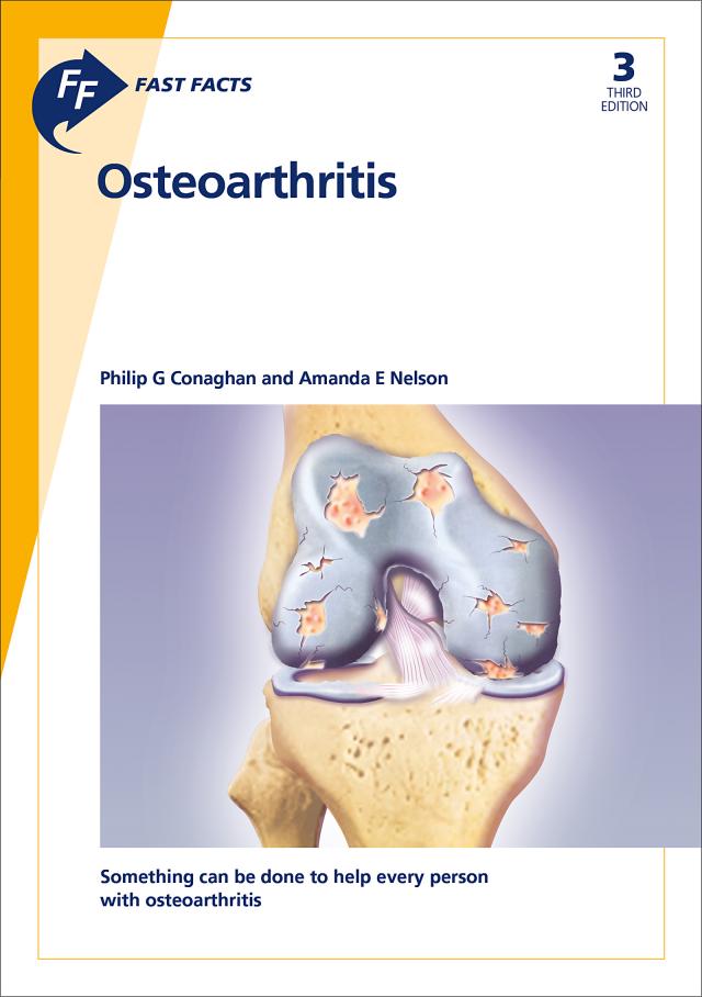 Fast Facts: Osteoarthritis