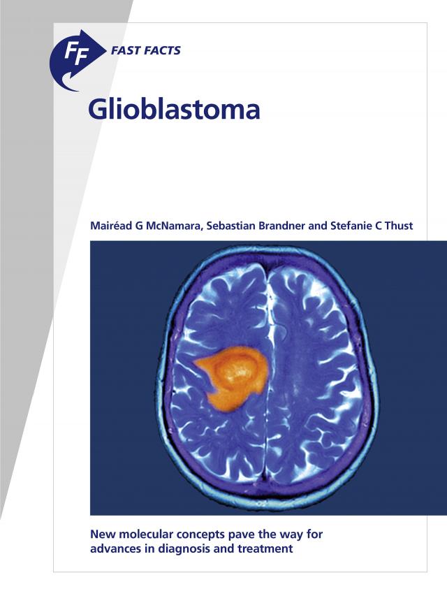 Fast Facts: Glioblastoma