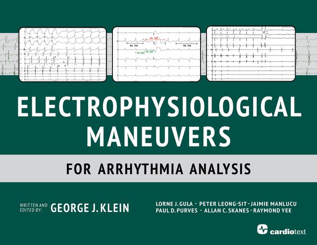 Electrophysiological Maneuvers for Arrhythmia Analysis