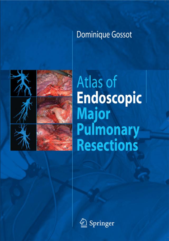 Atlas of endoscopic major pulmonary resections