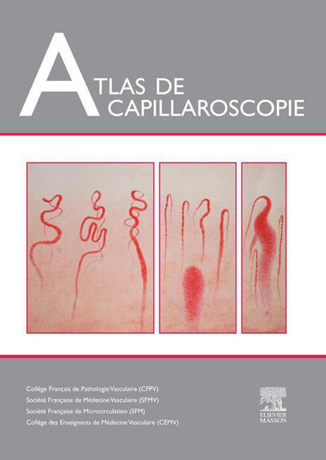 Atlas de capillaroscopie