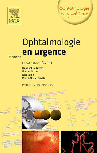 Ophtalmologie en urgence