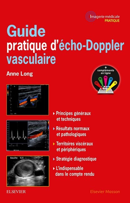 Guide pratique d''écho-Doppler vasculaire