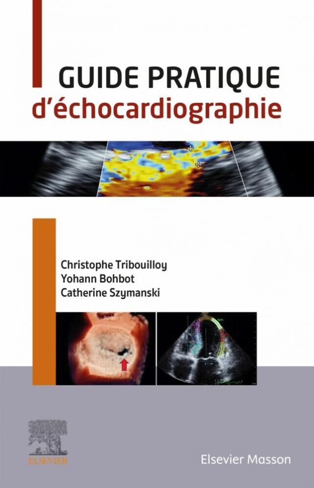 Guide pratique d''échocardiographie