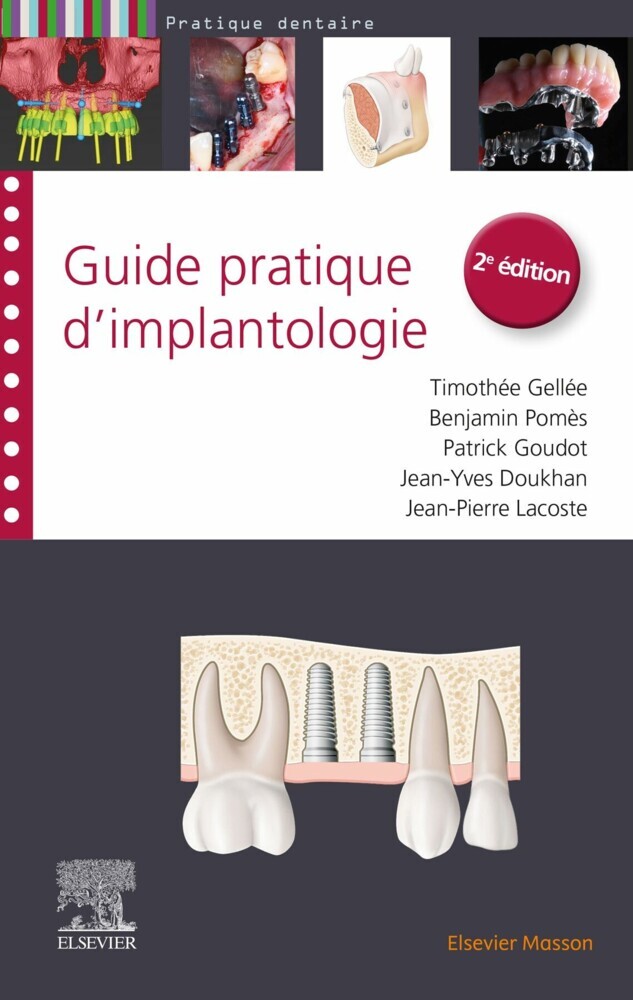 Guide pratique d''implantologie