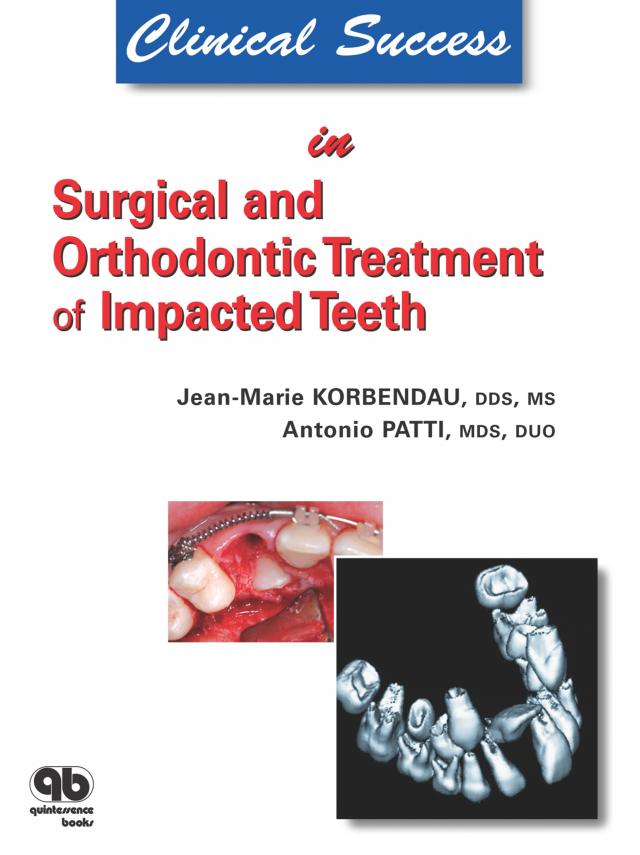 Clinical Success in Surgical and Orthodontic Treatment of Impacted Teeth