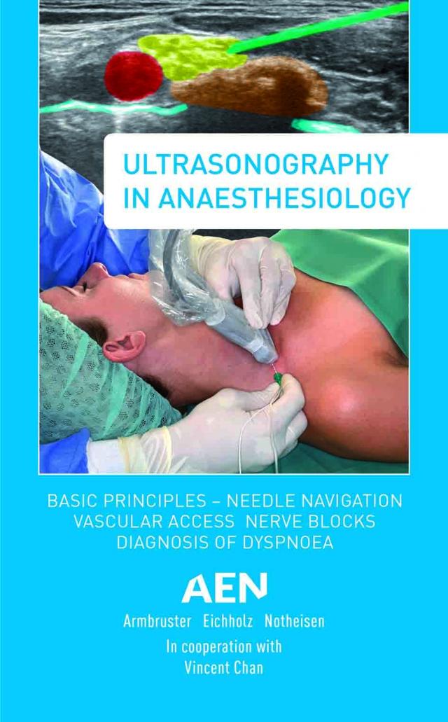 Ultrasonography in Anaesthesiology