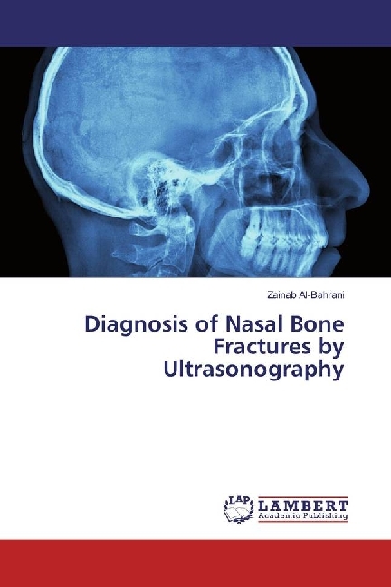 Diagnosis of Nasal Bone Fractures by Ultrasonography