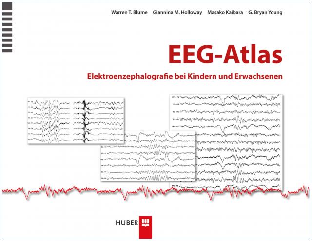EEG–Atlas