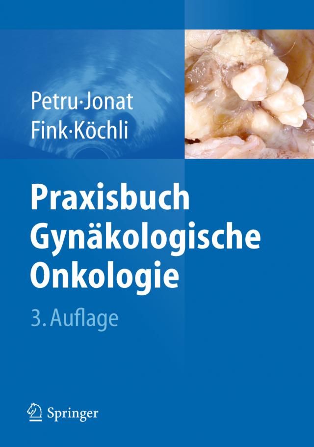 Praxisbuch Gynäkologische Onkologie