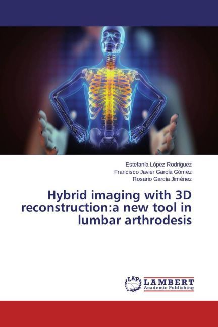 Hybrid imaging with 3D reconstruction:a new tool in lumbar arthrodesis