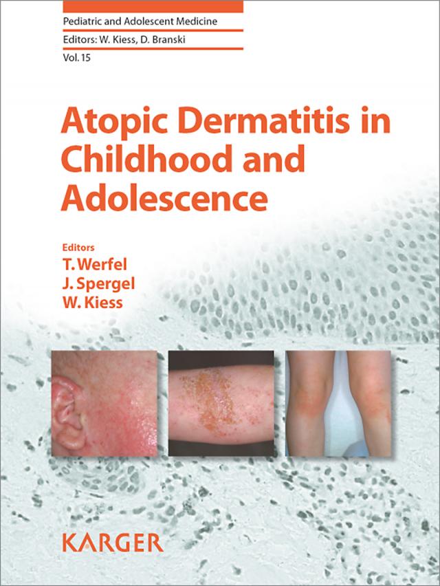 Atopic Dermatitis in Childhood and Adolescence