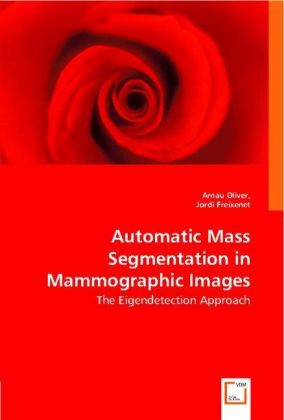 Automatic Mass Segmentation in Mammographic Images