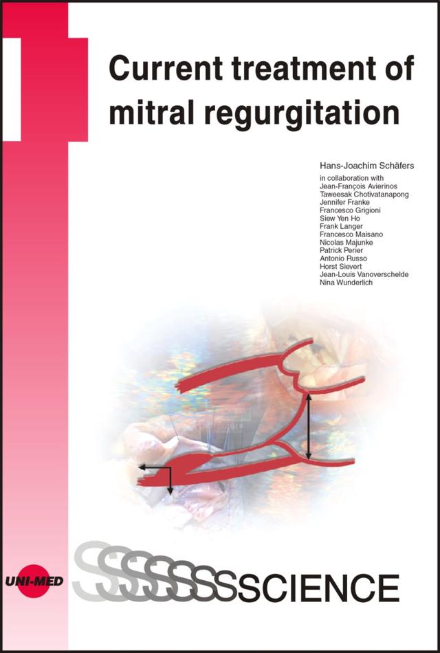 Current treatment of mitral regurgitation