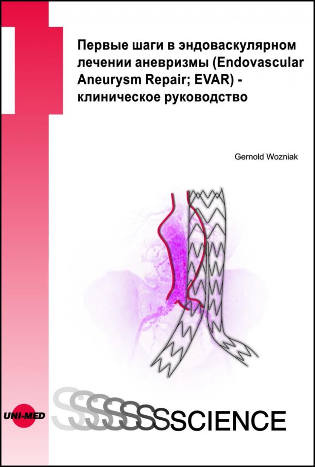First steps in EVAR - a clinical guide - Russian edition