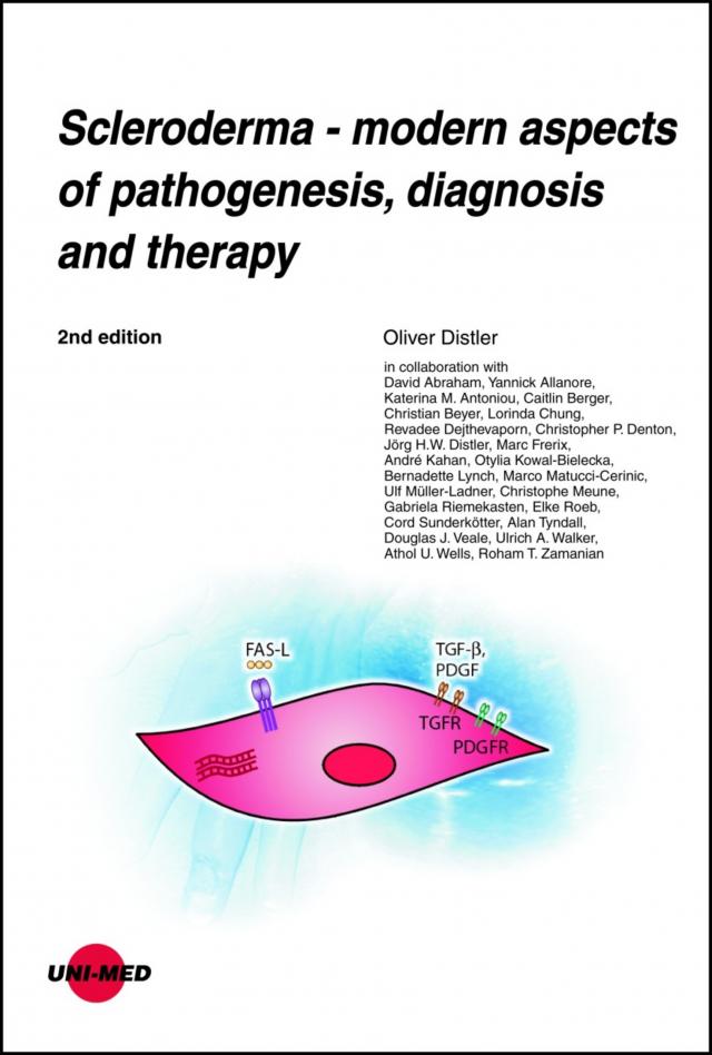 Scleroderma - modern aspects of pathogenesis, diagnosis and therapy