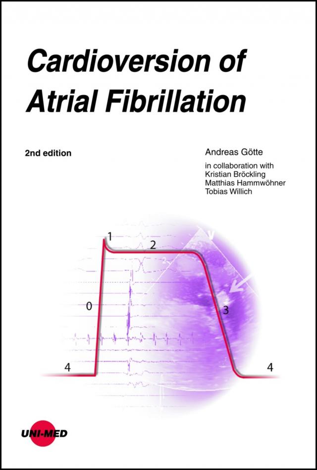 Cardioversion of Atrial Fibrillation