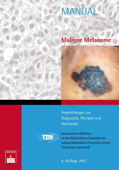 Manual Maligne Melanome