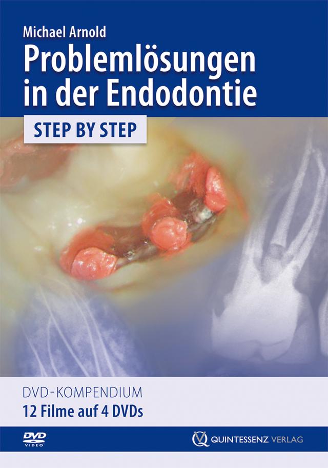 Problemlösungen in der Endodontie