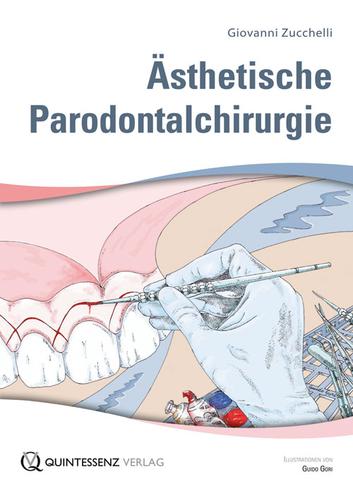Ästhetische Parodontalchirurgie