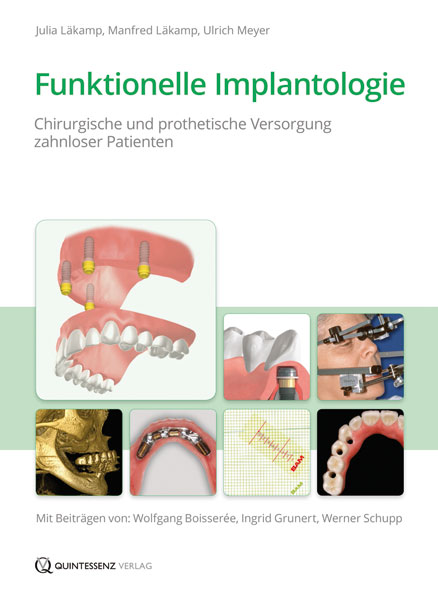 Funktionelle Implantologie