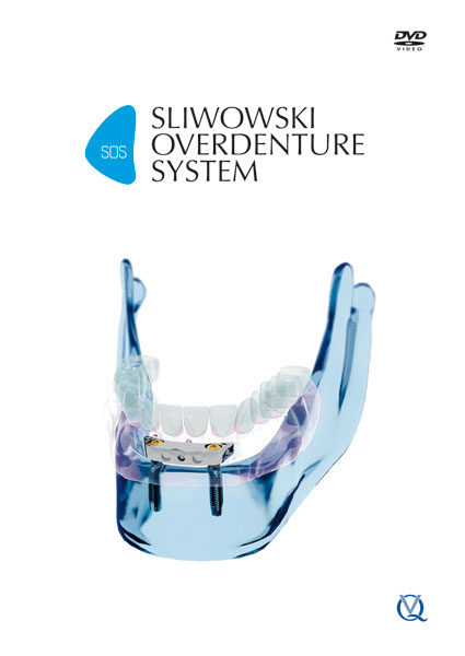 SOS – Sliwowski Overdenture System