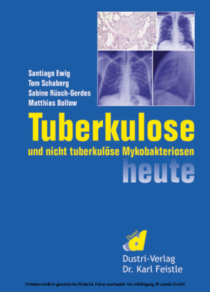 Tuberkulose und nicht tuberkulöse Mykobakteriosen heute