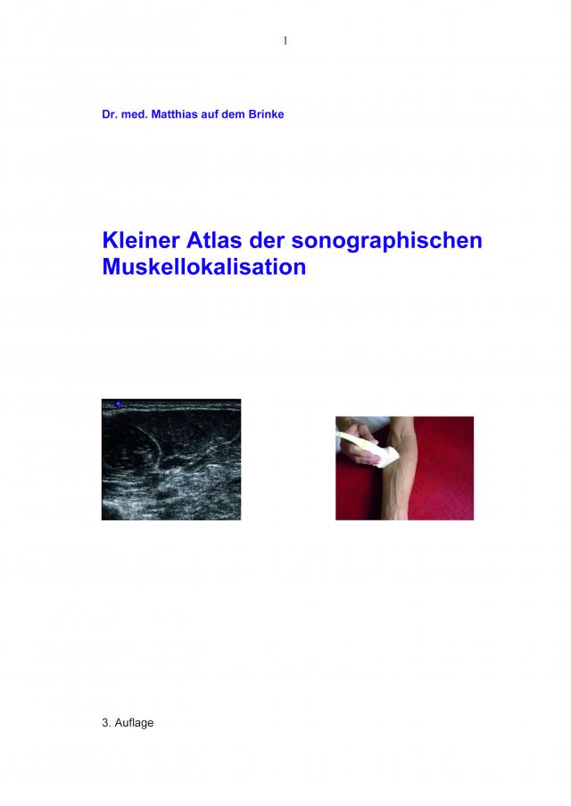 Kleiner Atlas der sonographischen Muskellokalisation