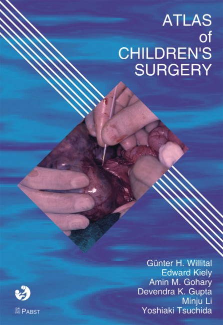 Atlas of Children's Surgery
