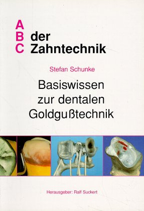 Basiswissen zur dentalen Goldgusstechnik