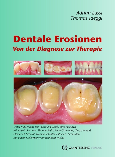 Dentale Erosionen