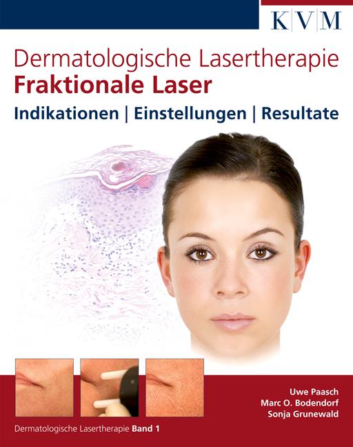 Dermatologische Lasertherapie Band 1: Fraktionale Laser
