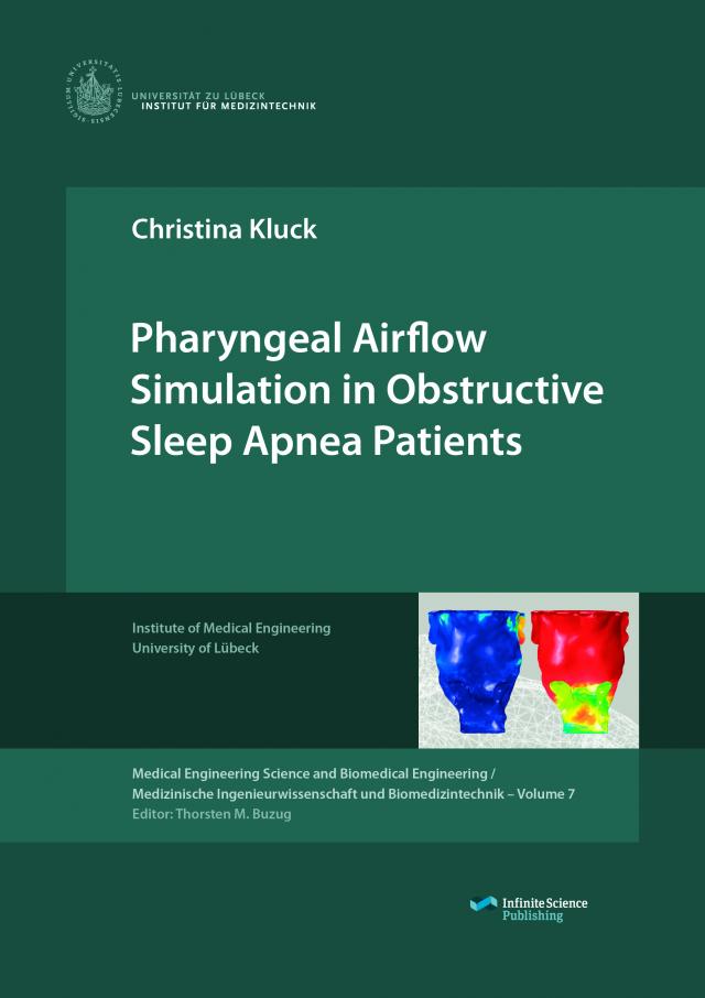 Pharyngeal Airflow Simulation in Obstructive Sleep Apnea Patients