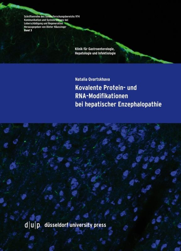 Kovalente Protein- und RNA-Modifikationen bei hepatischer Enzephalopathie