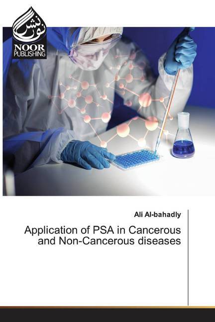 Application of PSA in Cancerous and Non-Cancerous diseases