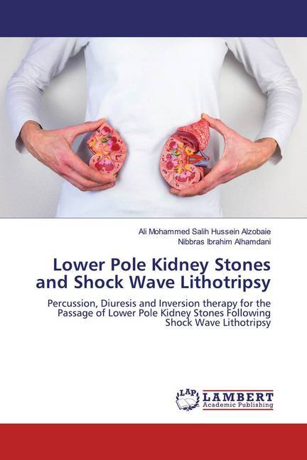 Lower Pole Kidney Stones and Shock Wave Lithotripsy