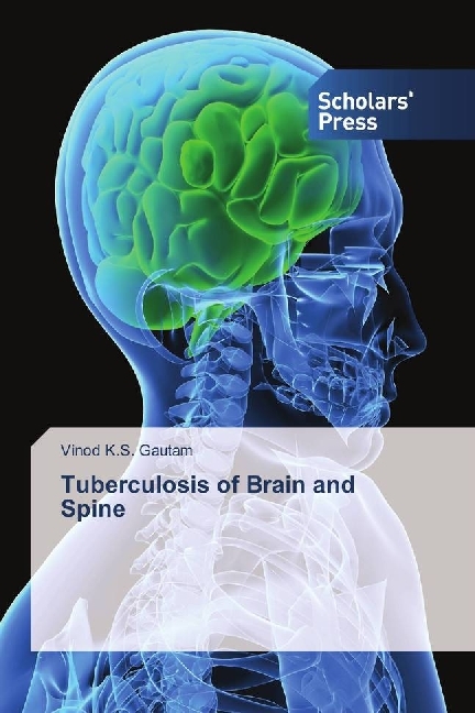 Tuberculosis of Brain and Spine
