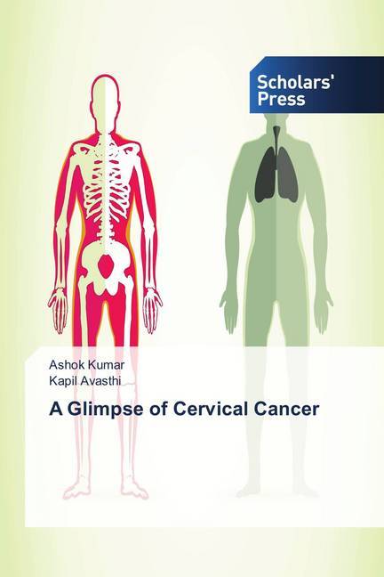 A Glimpse of Cervical Cancer