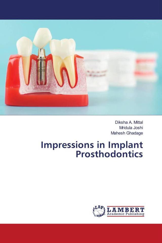 Impressions in Implant Prosthodontics