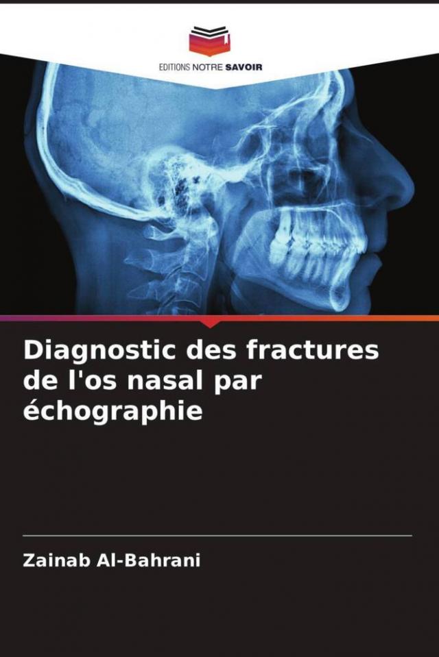 Diagnostic des fractures de l'os nasal par échographie
